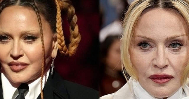 Madonna được khen khuôn mặt không còn đơ cứng tại Met Gala