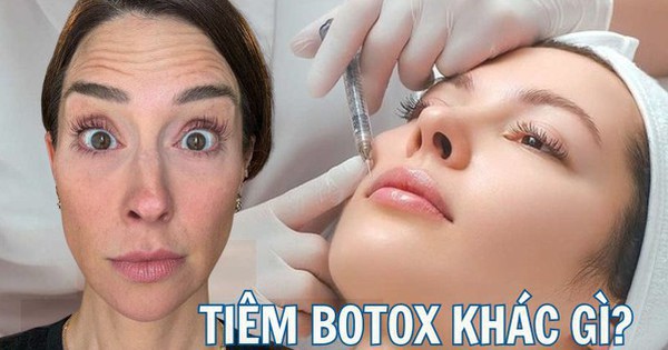 Tiêm botox vào một nửa khuôn mặt để xem ảnh hưởng thế nào đến vẻ bề ngoài: Nữ y tá "gây sốt" khi hé lộ kết quả!