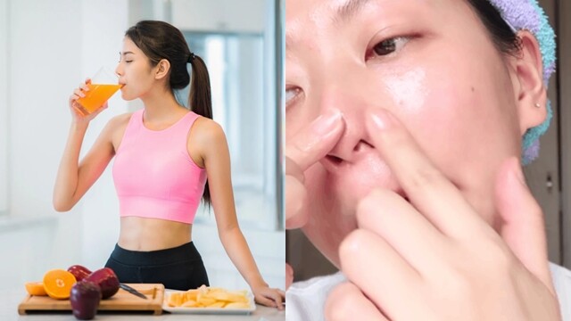 Muốn trị dứt điểm mụn đầu đen? Tránh xa 3 thực phẩm này nếu không muốn công sức skincare đổ sông đổ biển