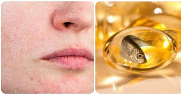 5 dấu hiệu cho thấy cơ thể bạn đang thiếu Omega-3