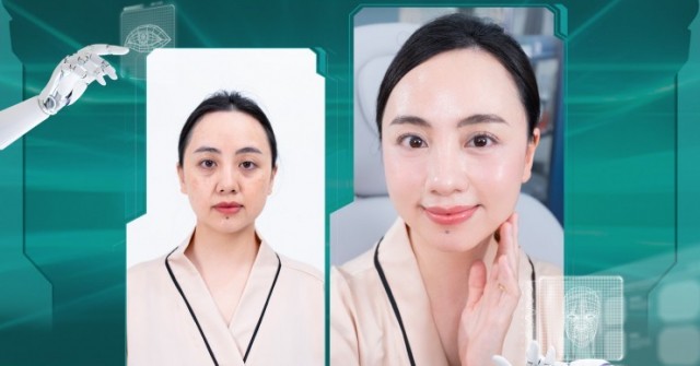 Trẻ hóa da AICollaBoost – Bí quyết giữ mãi làn da không tuổi
